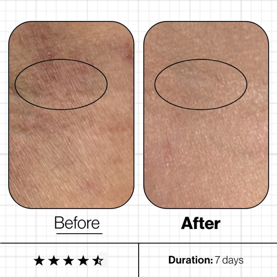 Skin Moisture IQ Supplement